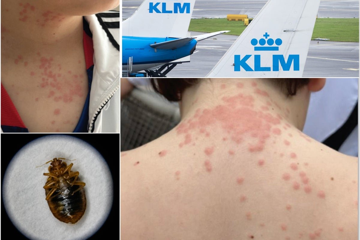 bed bugs on plane seat